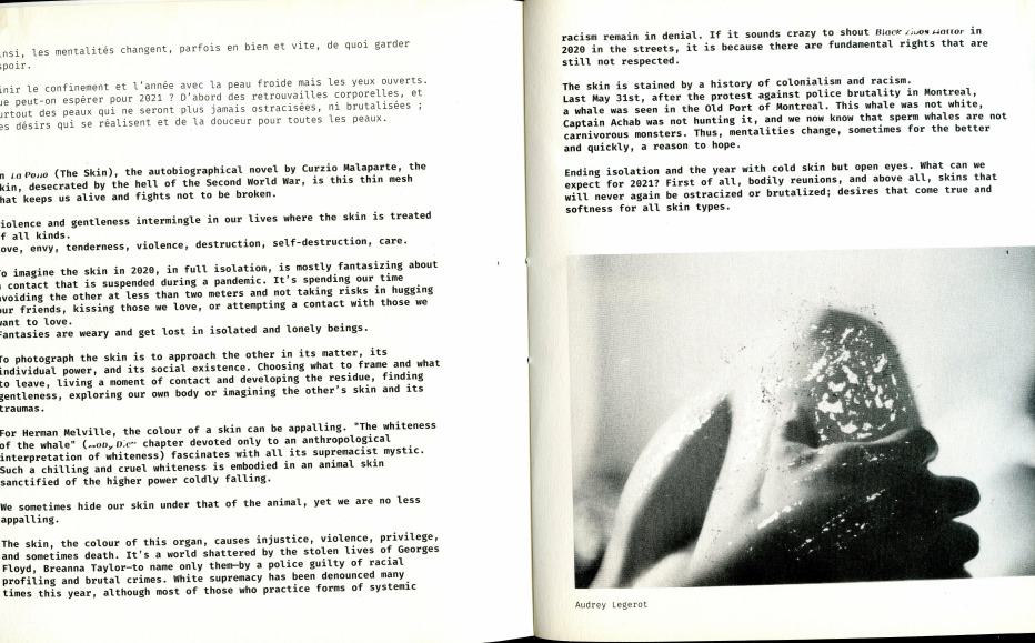 second page, with the rest of the introduction text and a black and white picture of a hand on a thigh